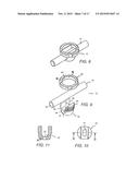 BONE FIXING SYSTEM AND METHOD OF USE diagram and image