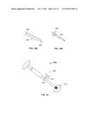 METHOD AND SYSTEM FOR ALIGNING A PROSTHESIS DURING SURGERY diagram and image