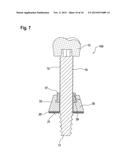 IMPLANT FOR BONE DISTRACTION diagram and image