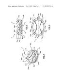 VALVE PROSTHESIS diagram and image