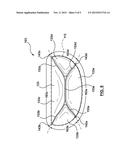 VALVE PROSTHESIS diagram and image