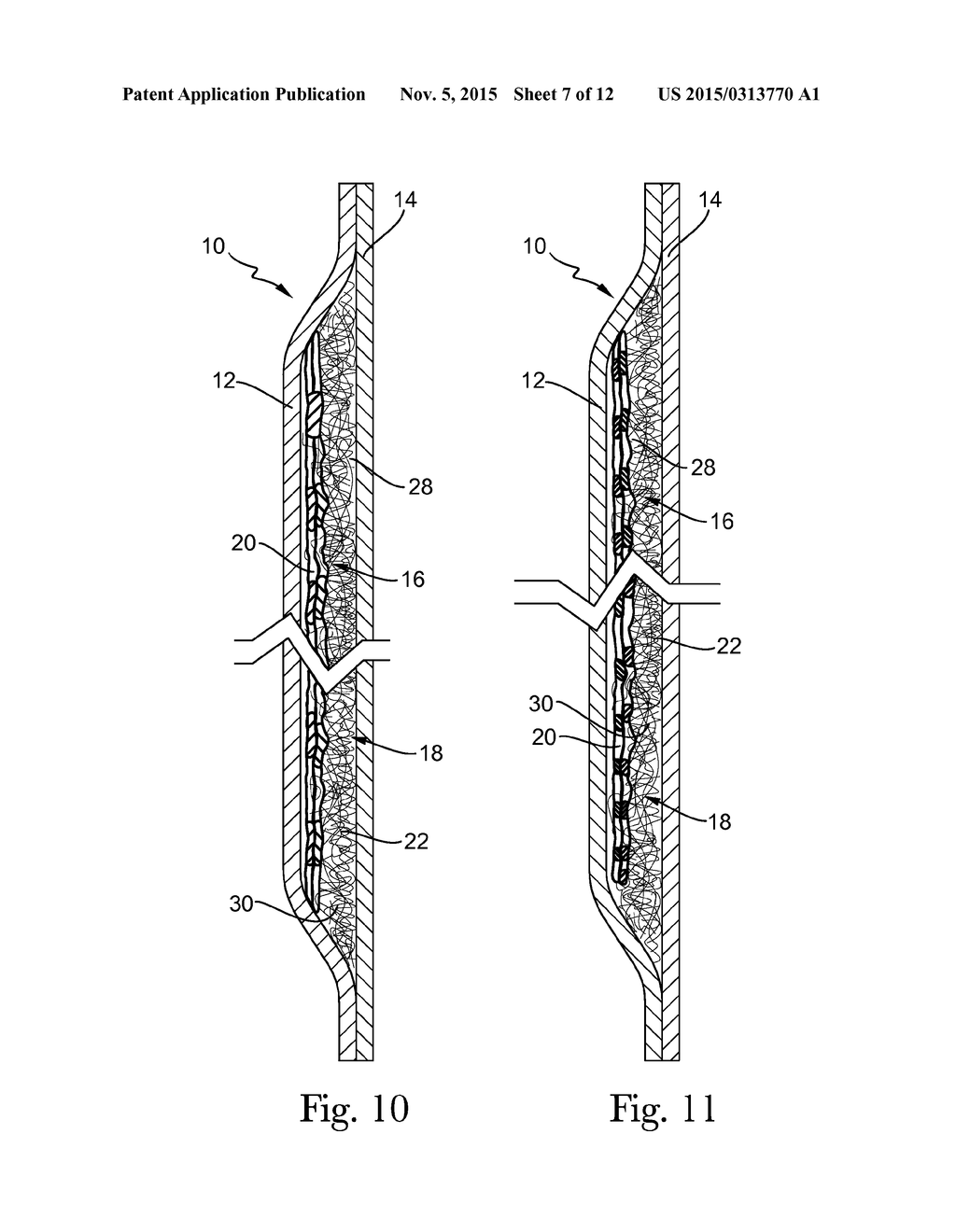 HETEROGENOUS MASS CONTAINING FOAM - diagram, schematic, and image 08