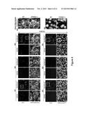 Composition and Method for Treating Neuronal Ceroid Lipofuscinosis diagram and image