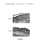 Methods and Agents for Wound Healing diagram and image