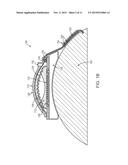 IMPLANTABLE DRUG-DELIVERY DEVICES, AND APPARATUS AND METHODS FOR FILLING     THE DEVICES diagram and image