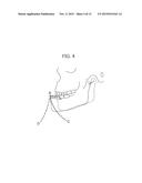 MOUTH-OPENING TRAINING DEVICE diagram and image