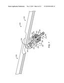 METHOD AND SYSTEM FOR INCREASING A BASKETBALL PLAYERS SHOOTING ACCURACY diagram and image