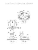 Bite Proof Spout diagram and image