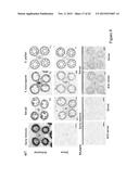 MUTATED NUCLEOTIDE MOLECULE, AND TRANSFORMED PLANT CELLS AND PLANTS     COMPRISING THE SAME diagram and image