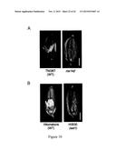 MUTATED NUCLEOTIDE MOLECULE, AND TRANSFORMED PLANT CELLS AND PLANTS     COMPRISING THE SAME diagram and image