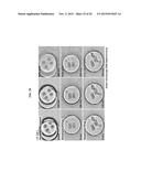 RAPID ANTIBIOTIC SUSCEPTIBILITY TESTING SYSTEM BASED ON BACTERIAL     IMMOBILIZATION USING GELLING AGENT, ANTIBIOTIC DIFFUSION AND TRACKING OF     SINGLE BACTERIAL CELLS diagram and image