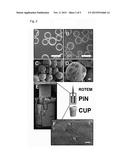 METHOD FOR MEASURING COAGULATION OF BLOOD SAMPLES USING VISCOELASTIC TESTS     (VET) diagram and image