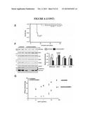 Sumoylation of SERCA2a and Cardiovascular Disease diagram and image