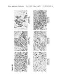 Human Notch Receptor Mutations and Their Use diagram and image