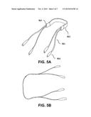 Eyeglass Retention Device diagram and image