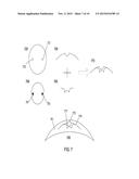 THERMOFORMED OPHTHALMIC INSERT DEVICES diagram and image