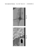 POLYMER FUNCTIONALIZED GRAPHENE OXIDE AND THERMALLY RESPONSIVE ION     PERMEABLE MEMBRANES MADE THEREFROM diagram and image