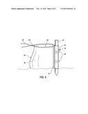 Beach Umbrella Anchor Stand diagram and image