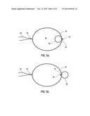 Beach Umbrella Anchor Stand diagram and image