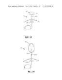 Basting Cooking Utensil and Method diagram and image