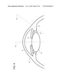 OPHTHALMOLOGIC IMAGING APPARATUS diagram and image