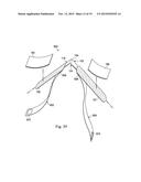 LABOR MANAGEMENT DEVICES FOR PELVIC FLOOR SUPPORT diagram and image