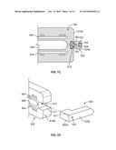 Patient-Specific Elbow Guides And Associated Methods diagram and image