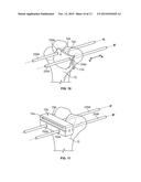 Patient-Specific Elbow Guides And Associated Methods diagram and image