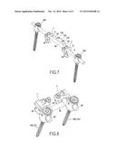 DEVICE FOR FIXING A BONY STRUCTURE TO A SUPPORT MEMBER diagram and image