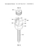 METHODS AND APPARATUS FOR ACCESS TO AND/OR TREATMENT OF THE SPINE diagram and image