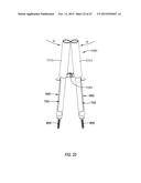 METHODS AND APPARATUS FOR ACCESS TO AND/OR TREATMENT OF THE SPINE diagram and image