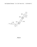 METHODS AND APPARATUS FOR ACCESS TO AND/OR TREATMENT OF THE SPINE diagram and image