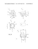 IMPLANT FIXATION ASSEMBLIES HAVING A SCREW AND C-SHAPED FIXATION COLLAR diagram and image