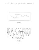 IMPLANT FIXATION ASSEMBLIES HAVING A SCREW AND C-SHAPED FIXATION COLLAR diagram and image