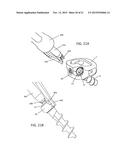 IMPLANT FIXATION ASSEMBLIES HAVING A SCREW AND C-SHAPED FIXATION COLLAR diagram and image