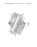 ELECTRICALLY CONDUCTIVE/INSULATIVE OVER-SHOE FOR TISSUE FUSION diagram and image