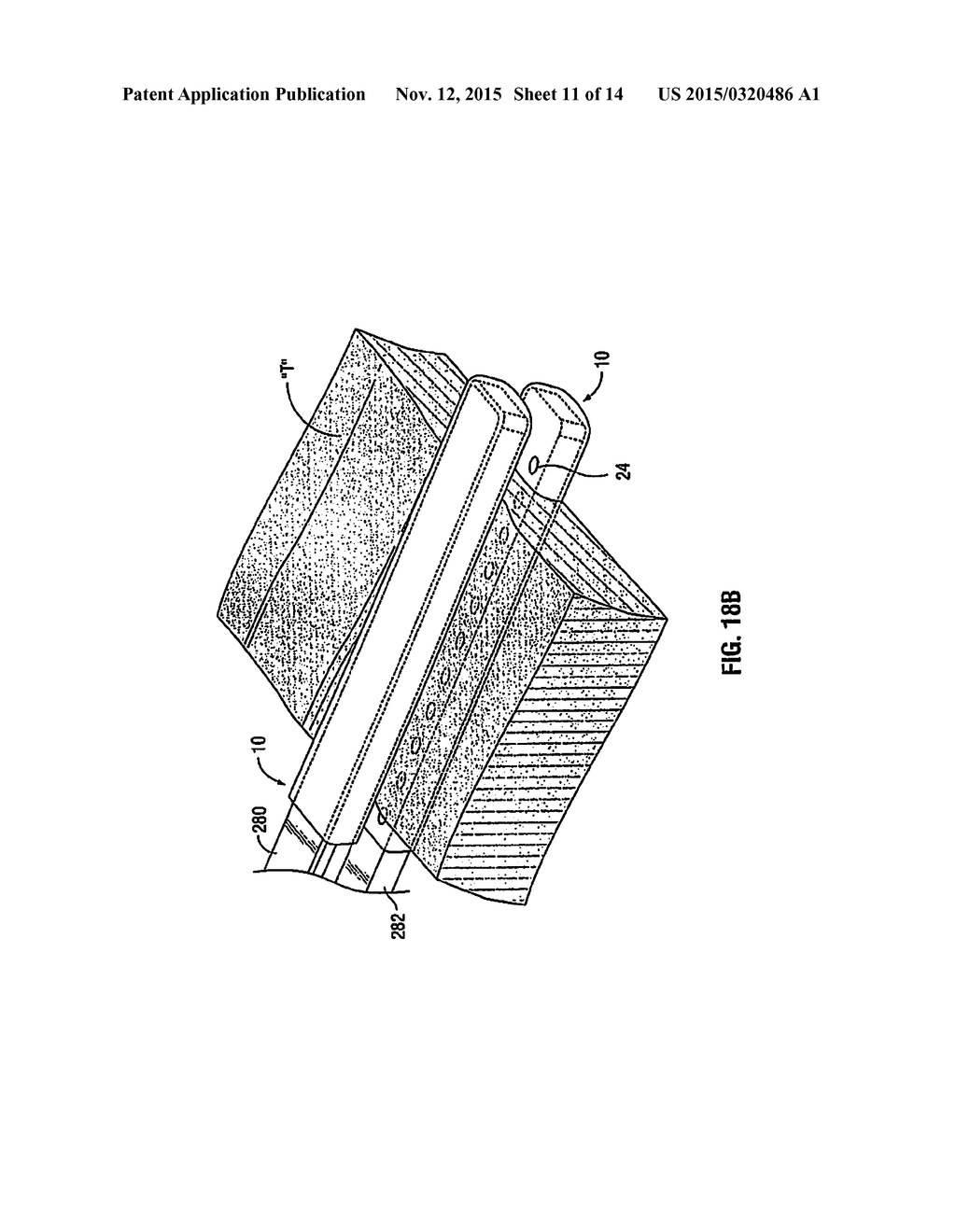 ELECTRICALLY CONDUCTIVE/INSULATIVE OVER-SHOE FOR TISSUE FUSION - diagram, schematic, and image 12