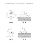 ABLATION PROBE FIXATION diagram and image