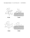 ABLATION PROBE FIXATION diagram and image