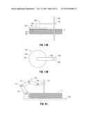 ABLATION PROBE FIXATION diagram and image