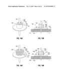 ABLATION PROBE FIXATION diagram and image