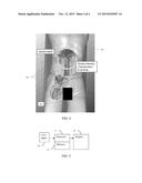 PATH CREATION USING MEDICAL IMAGING FOR PLANNING DEVICE INSERTION diagram and image