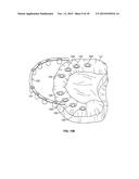 COMPONENTS FOR USE WITH A SURGICAL GUIDE FOR DENTAL IMPLANT PLACEMENT diagram and image