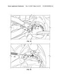 COMPONENTS FOR USE WITH A SURGICAL GUIDE FOR DENTAL IMPLANT PLACEMENT diagram and image