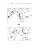 COMPONENTS FOR USE WITH A SURGICAL GUIDE FOR DENTAL IMPLANT PLACEMENT diagram and image