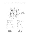 REPLACEMENT HEART VALVES AND THEIR METHODS OF USE AND MANUFACTURE diagram and image