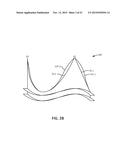 REPLACEMENT HEART VALVES AND THEIR METHODS OF USE AND MANUFACTURE diagram and image