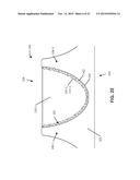 REPLACEMENT HEART VALVES AND THEIR METHODS OF USE AND MANUFACTURE diagram and image