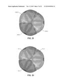 REPLACEMENT HEART VALVES AND THEIR METHODS OF USE AND MANUFACTURE diagram and image