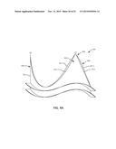 REPLACEMENT HEART VALVES AND THEIR METHODS OF USE AND MANUFACTURE diagram and image